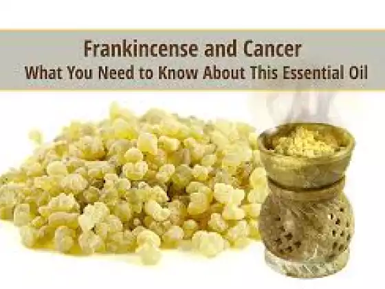 Frankincense Essential Oil